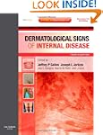 Dermatological Signs of Internal Dise...