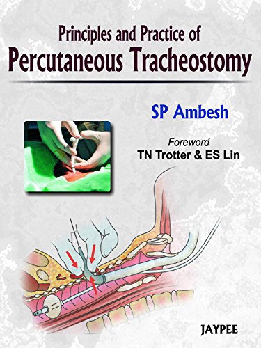 Principles and Practice of Percutaneous Tracheostomy