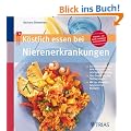 K�stlich essen bei Nierenerkrankung: So unterst�tzen Sie Ihre Nieren mit der richtigen Ern�hrung / Vom Snack bis zum Festtagsmen� / Mit 130 abwechslungsreichen Rezepten