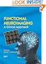 Functional Neuroradiology