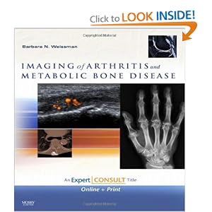 Click here to buy Imaging of Arthritis and Metabolic Bone Disease: Expert Consult - Online and Print by Barbara N. W. Weissman MD.