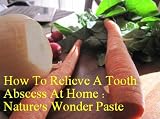 How To Relieve A Tooth Abscess At Home : Nature's Wonder Paste