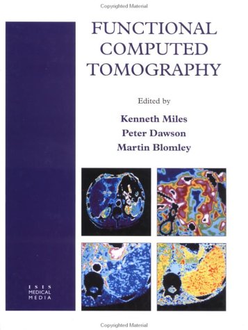 Computed-Tomography