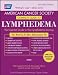 ACS Complete Guide to Lymphedema: Understanding and Managing Lymphedema After Cancer Treatment width=