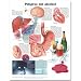 Dangers of Alcohol Anatomical Chart in Spanish (Peligros del alcohol)