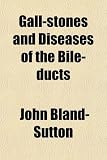 Gall-stones and Diseases of the Bile-ducts