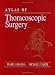 Books : Atlas of Thoracoscopic Surgery