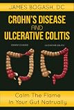 Crohns Disease and Ulcerative Colitis: Calm the Flame in Your Gut Naturally