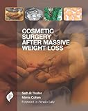 Cosmetic surgery after massive weight loss