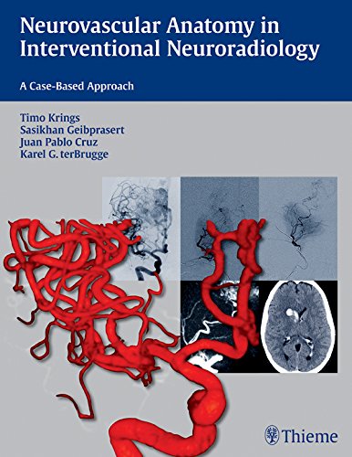 Neurovascular Anatomy in Interventional Neuroradiology: A Case-Based Approach