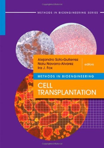Cell Transplantation (Methods in Bioengineering)
