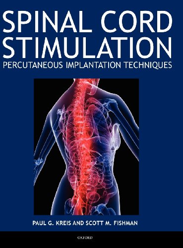 Spinal Cord Stimulation Implantation: Percutaneous Implantation Techniques