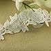 Yontree Venise Lace Applique