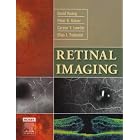 Click here to buy Retinal Imaging by David Huang, Peter K. Kaiser, Careen Y. Lowder, and Elias Traboulsi.