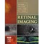 Retinal Imaging