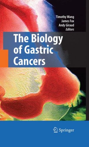 Gastric-Cancer