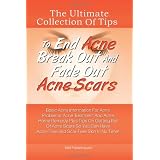 The Ultimate Collection Of Tips To End Acne Break Out And Fade Out Acne Scars: Basic Acne Information For Acne Problems, Acne Treatment And Acne Home Remedy ... Acne-Free and Scar-Free Skin In No Time!