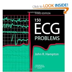 150 ECG Problems