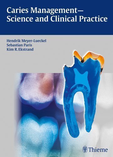 Caries Management - Science and Clinical Practice 1st (first) Edition published by Thieme (2013)