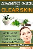 Advanced Guide to Clear Skin: How To Get Rid of Acne Naturally with Home Remedies That Actually Work 51OKU8ZP%2BeL. SL160 Advanced Guide to Clear Skin: How To Get Rid of Acne Naturally with Home Remedies That Actually Work