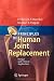 Principles of Human Joint Replacement: Design and Clinical Application