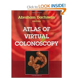 Click here to buy Atlas of Virtual Colonoscopy by Abraham H. Dachman, J.T. Ferrucci, and J.H. Bond.