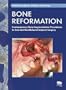 Bone Reformation: Contemporary Bone Augmentation Procedures in Oral and Maxillofacial Implant Surgery