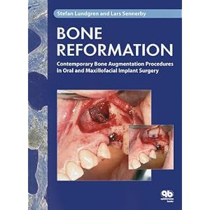 Click here to buy Bone Reformation: Contemporary Bone Augmentation Procedures in Oral and... by Stefan Lundgren and Lars Sennerby.