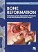 Search : Bone Reformation: Contemporary Bone Augmentation Procedures in Oral and Maxillofacial Implant Surgery