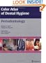 Color Atlas of Dental Hygiene: Periodontology