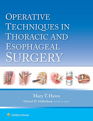 Operative Techniques in Thoracic Surgery
