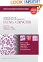Advances in Surgical Pathology: Lung Cancer
