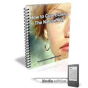 How to Cure Eczema the Natural Way
