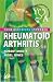 Rheumatoid Arthritis: Your Questions Answered