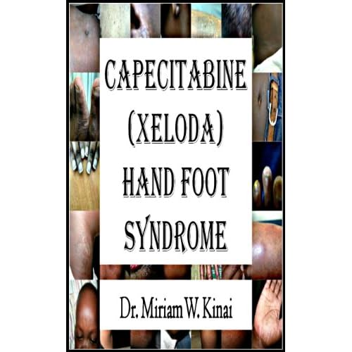 Image Capecitabine (Xeloda) Hand Foot Syndrome (Skin Diseases Book 14