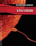 In vitro fertilization