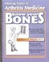 Know Your Bones: Making Sense of Arthritis Medicine