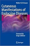 Cutaneous Manifestations of Endocrine Diseases