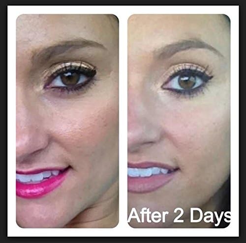 Ice Elements™ 2 Minute Miracle Gel 3 x 3g Single Use Sachets - New Formulation - Guaranteed Parabens Free!