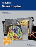 Neuro Imaging (Radcases)