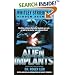 Casebook: Alien Implants (Whitley Strieber's Hidden Agendas)