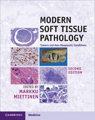 Modern Soft Tissue Pathology: Tumors and Non-Neoplastic Conditions