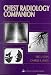 Books : Chest Radiology Companion: Methods, Guideline and Imaging Fundamentals (Imaging Companion Series)