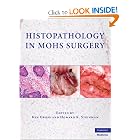 Click here to buy Mohs Surgery and Histopathology: Beyond the Fundamentals by Ken Gross and Howard K. Steinman.