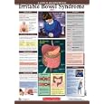 Diseases Explained: Irritable Bowel Syndrome Wall Chart by  Lexi-Comp