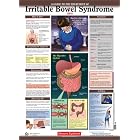 Diseases Explained: Irritable Bowel Syndrome Wall Chart by Lexi-Comp