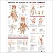 Search : Anatomy and Injuries of the Hand and Wrist Anatomical Chart 20" X 26" Laminated