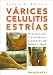 image 24  - Varices Celulitis Estrias  Varix Cellulite Strias Prevencion
