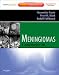 Meningiomas: Expert Consult - Online and Print (Expert Consult Title: Online + Print) Cover