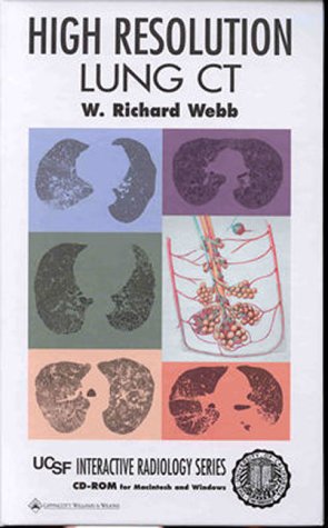 high resolution lung ct cd rom for windows  macintosh